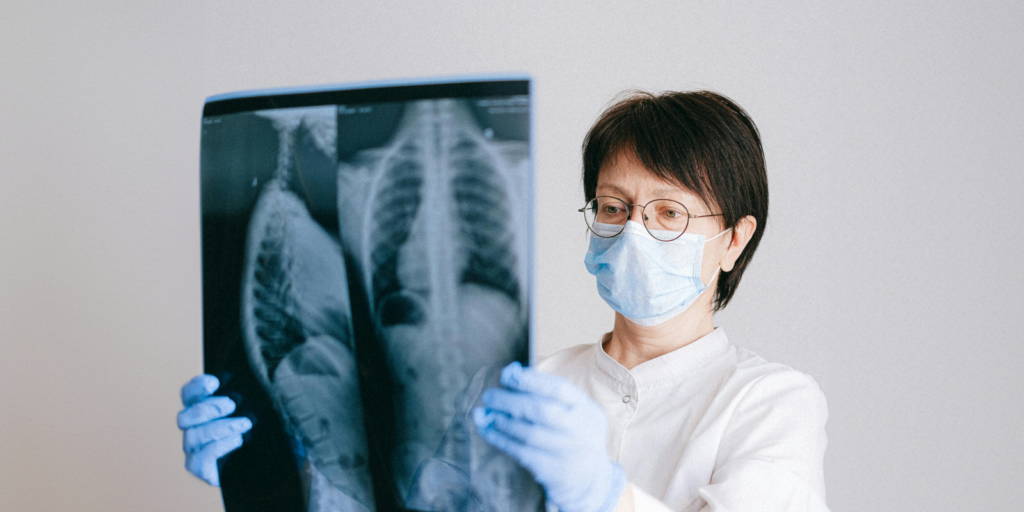 woman looking at an x-ray