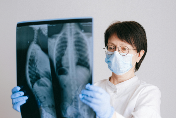 woman looking at an x-ray