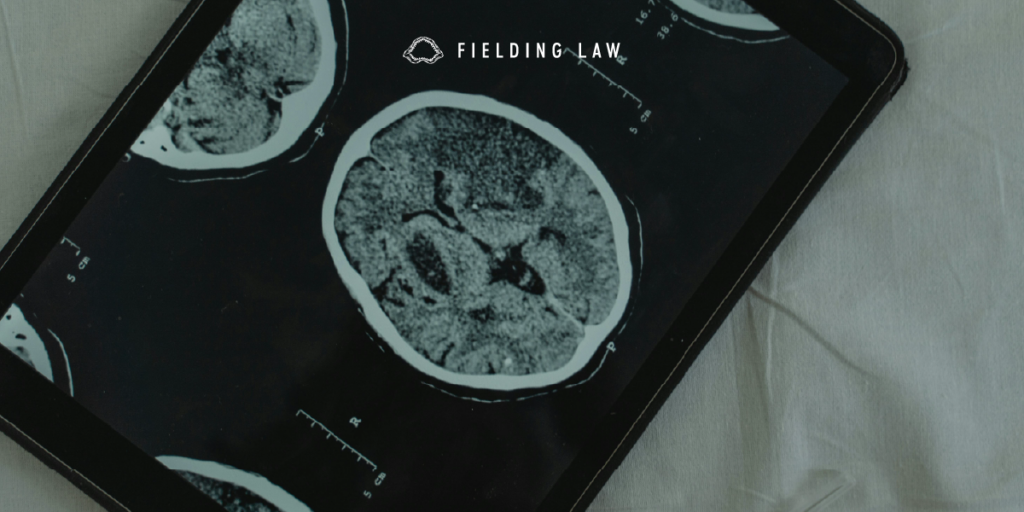 Brain injury scan by an expert doctor on a tablet