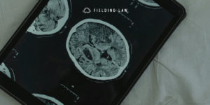 Brain injury scan by an expert doctor on a tablet