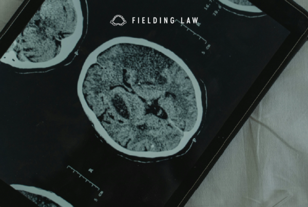 Brain injury scan by an expert doctor on a tablet