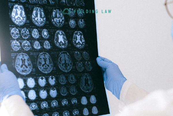 Doctor looking at a brain scan