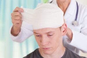 Common Brain Injuries in Irvine, California